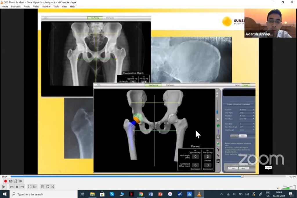 Talk On ‘Robotic Thr – Does It Make A Difference?’ - Image 1