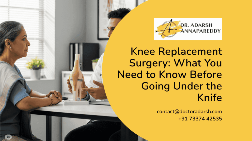 Knee Replacement Surgery_ What You Need to Know Before Going Under the Knife