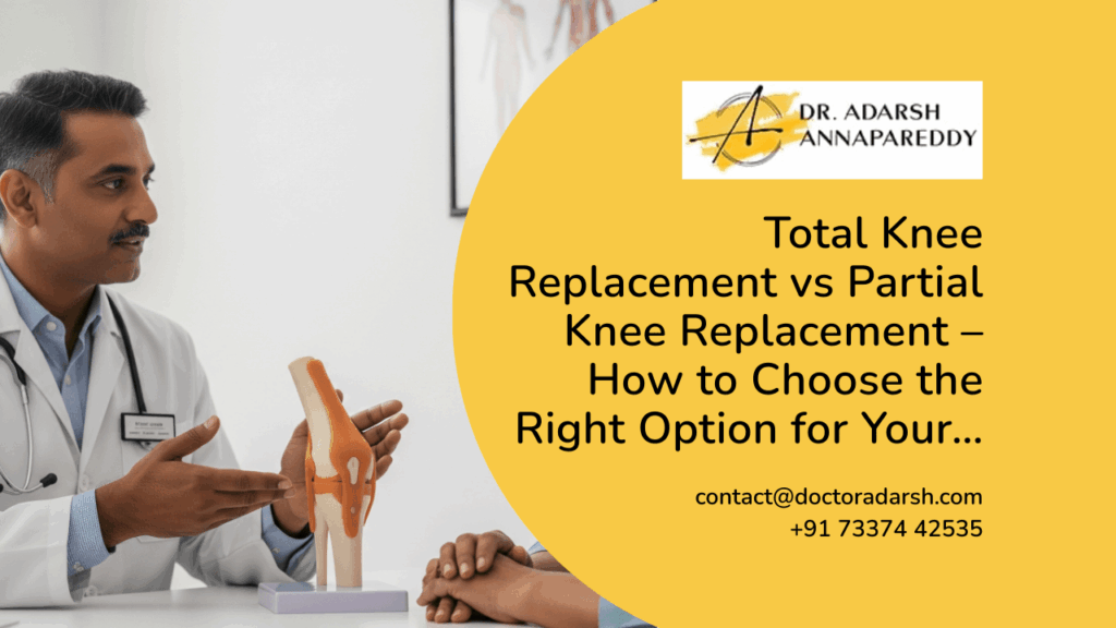 Total Knee Replacement vs Partial Knee Replacement – How to Choose the Right Option for Your…