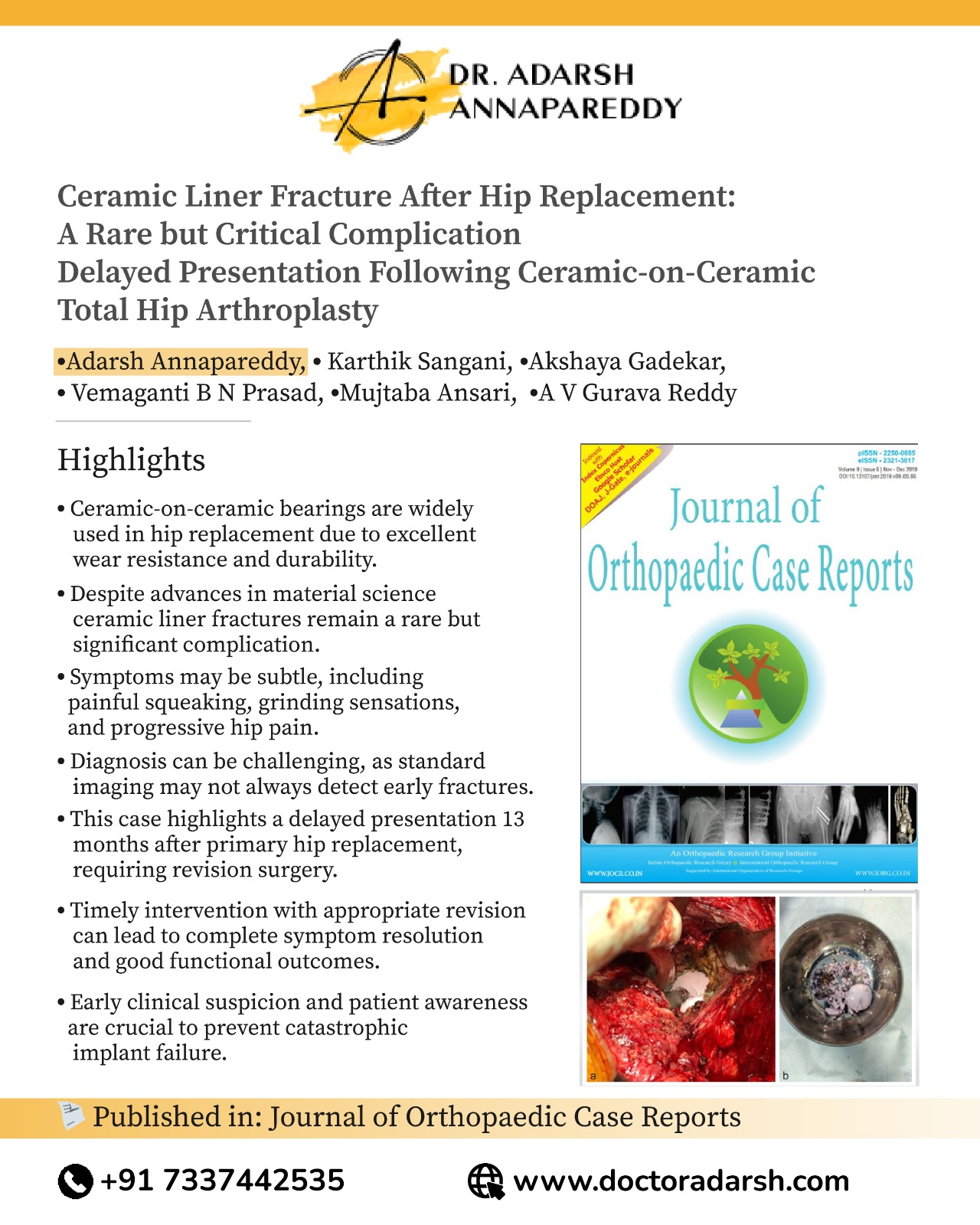 Total Hip Arthroplasty