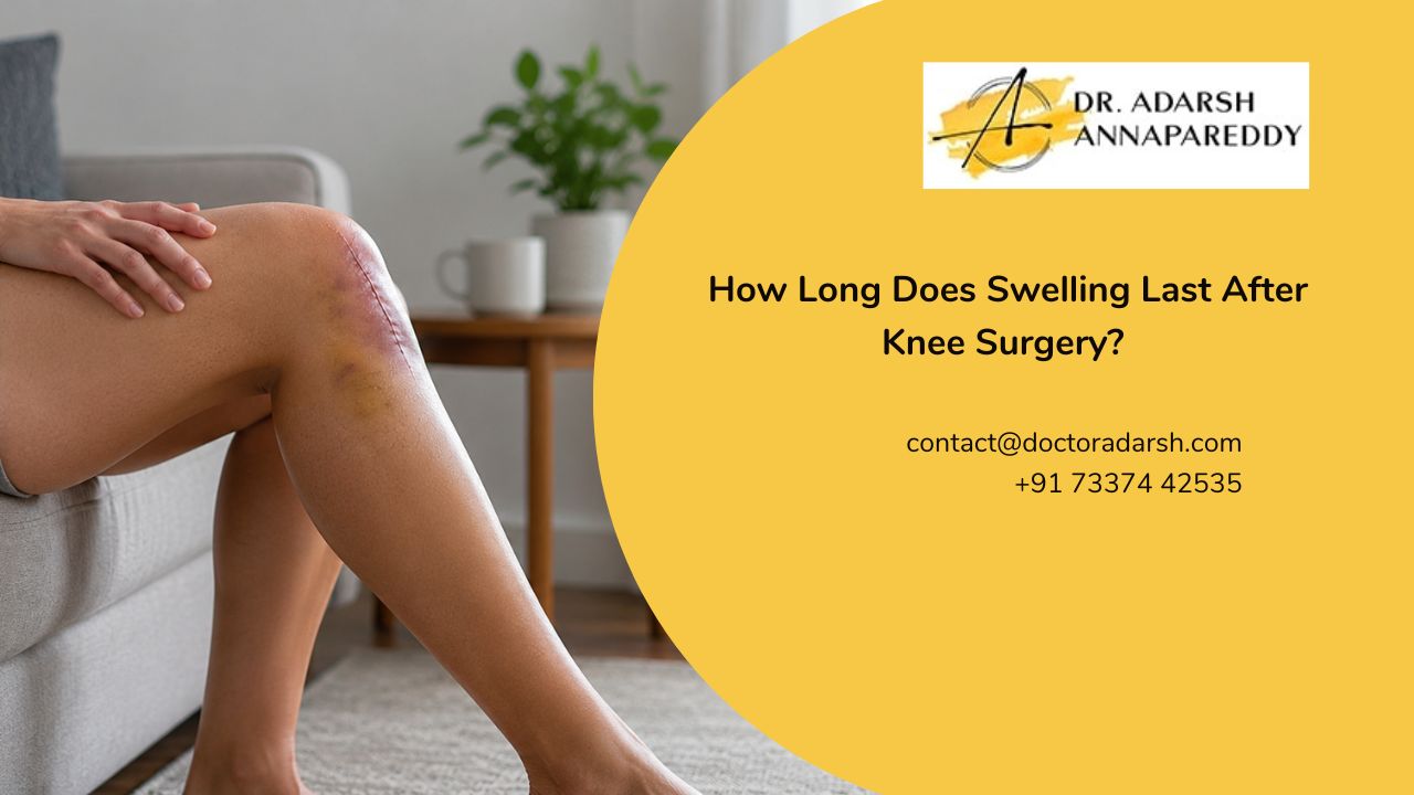 How Long Does Swelling Last After Knee Surgery?