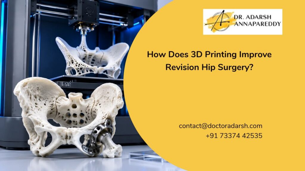 How Does 3D Printing Improve Revision Hip Surgery