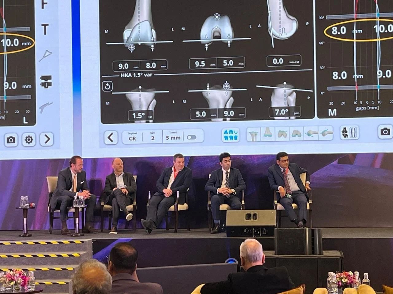Advancing Robotic Knee Replacement: Insights from the VELYS™ Knee Mastery Symposium